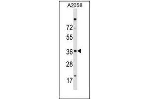 Western blot analysis of Islet-2 / ISL2 Antibody (N-term) in A2058 cell line lysates (35ug/lane). (ISL2 抗体  (N-Term))