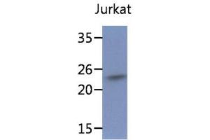 The cell lysates (40ug) were resolved by SDS-PAGE, transferred to PVDF membrane and probed with anti-human SSR2 antibody (1:1000).