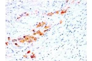 Formalin-fixed, paraffin-embedded human Bladder stained with CD44v4 Mouse Recombinant Monoclonal Antibody (rCD44v4/1219). (Recombinant CD44 抗体)