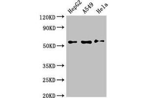Western Blot Positive WB detected in: HepG2 whole cell lysate, A549 whole cell lysate, Hela whole cell lysate All lanes: NECTIN2 antibody at 3 μg/mL Secondary Goat polyclonal to rabbit IgG at 1/50000 dilution Predicted band size: 58, 52 kDa Observed band size: 58 kDa (PVRL2 抗体  (AA 32-360))