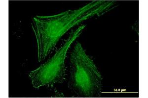 Immunofluorescence (IF) image for anti-Solute Carrier Family 27 (Fatty Acid Transporter), Member 2 (SLC27A2) (AA 25-123) antibody (ABIN524394)