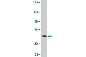 Western Blotting (WB) image for anti-Solute Carrier Family 28 (Sodium-Coupled Nucleoside Transporter), Member 2 (SLC28A2) (AA 1-79) antibody (ABIN522616)