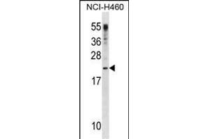 CSF3 Antibody (C-term) (ABIN1881232 and ABIN2838611) western blot analysis in NCI- cell line lysates (35 μg/lane). (G-CSF 抗体  (C-Term))