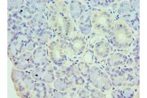 Immunohistochemistry of paraffin-embedded human pancreatic tissue using ABIN7155328 at dilution of 1:100 (HDAC8 抗体  (AA 1-377))