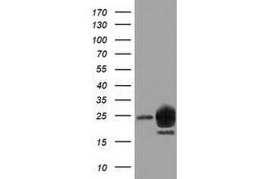 Western Blotting (WB) image for anti-Lin-7 Homolog B (LIN7B) antibody (ABIN1499157) (LIN7B 抗体)