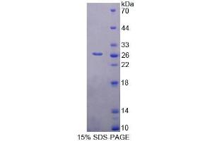 SDS-PAGE (SDS) image for BCL2-Associated Athanogene (BAG1) (AA 177-358) protein (His tag) (ABIN6239585) (BAG1 Protein (AA 177-358) (His tag))