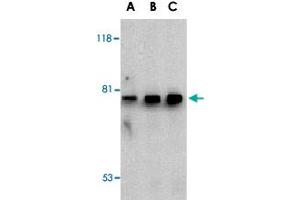 Western blot analysis of BTK in U-937 cell lysate with BTK polyclonal antibody  at (A) 0. (BTK 抗体  (N-Term))