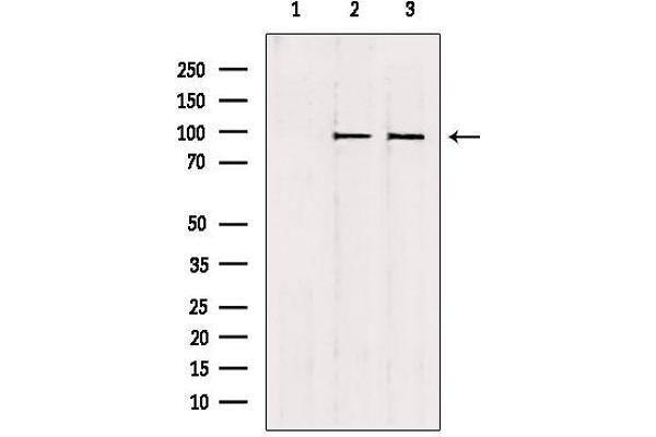 NSUN2 抗体  (Internal Region)