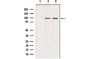 Western blot analysis of extracts from various samples, using NSUN2 antibody. (NSUN2 抗体  (Internal Region))