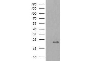 Image no. 1 for anti-HRas proto-oncogene, GTPase (HRAS) antibody (ABIN1498717) (HRAS 抗体)
