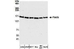 Western Blotting (WB) image for anti-PDS5, Regulator of Cohesion Maintenance, Homolog B (PDS5B) (AA 1200-1250) antibody (ABIN7455224)