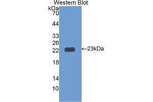 Western Blotting (WB) image for anti-Interleukin 12 Receptor beta 1 (IL12RB1) (AA 37-234) antibody (ABIN1174856) (IL12RB1 抗体  (AA 37-234))