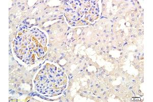 Formalin-fixed and paraffin embedded rat kidney labeled with Anti PNMT Polyclonal Antibody, Unconjugated  at 1:300 followed by conjugation to the secondary antibody and DAB staining (PNMT 抗体  (AA 101-200))