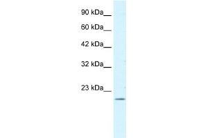 WB Suggested Antibody  Titration: 0. (FOXP2 抗体  (N-Term))
