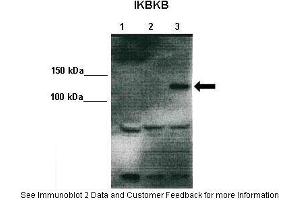 Lanes:   Lane 1: 10ug 293T lysate (empty vector) Lane 2: 10ug IKKalpha-V5 transfected 293T lysate Lane 3: 10ug IKKbeta-V5 transfected 293T  Primary Antibody Dilution:    1:1000  Secondary Antibody:   Anti-rabbit HRP  Secondary Antibody Dilution:    1:2000  Gene Name:   IKBKB  Submitted by:   Dr. (IKBKB 抗体  (Middle Region))