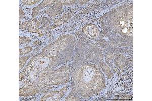 IHC analysis of HLA-DRA using anti-HLA-DRA antibody (ABIN7600950). (HLA-DRA 抗体  (AA 26-254))