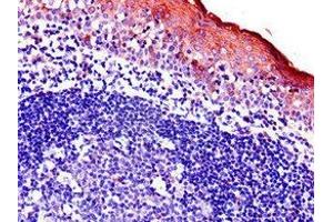 Immunohistochemistry of paraffin-embedded human tonsil tissue using ABIN7145203 at dilution of 1:100 (BIRC3 抗体  (AA 76-245))