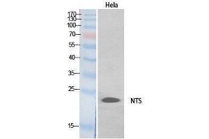 Western Blotting (WB) image for anti-Neurotensin (NTS) (Internal Region) antibody (ABIN3178551) (Neurotensin 抗体  (Internal Region))