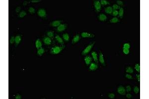 Immunofluorescent analysis of HepG2 cells using ABIN7150116 at dilution of 1:100 and Alexa Fluor 488-congugated AffiniPure Goat Anti-Rabbit IgG(H+L) (DNMT3B 抗体  (AA 1-100))