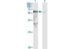 Western Blotting (WB) image for anti-Peptidase D (PEPD) (AA 1-493) antibody (ABIN562173)