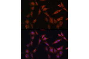 Immunofluorescence analysis of C6 cells using PFKFB2 Rabbit pAb (ABIN6129842, ABIN6145483, ABIN6145484 and ABIN6224971) at dilution of 1:100 (40x lens). (PFKFB2 抗体  (AA 446-505))