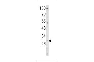 Western blot analysis of TR Antibody (C-term) 6545b in K562 cell line lysates (35 μg/lane). (CD40 Ligand 抗体  (C-Term))