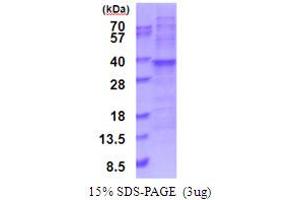 SDS-PAGE (SDS) image for Ribosomal Protein L7a (RPL7A) (AA 1-266) protein (His tag) (ABIN5853975) (RPL7A Protein (AA 1-266) (His tag))