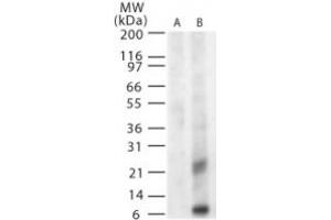 WNVM Western Blot. (WNV M 抗体)
