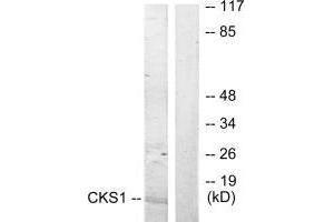 Western blot analysis of extracts from Jurkat cells, treated with serum (20 % , 15 mins), using CKS1 antibody. (CKS1 抗体  (N-Term))