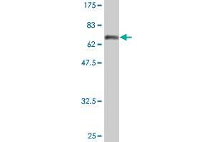 Western Blot detection against Immunogen (74. (Fatty Acid Synthase 抗体  (AA 1-439))