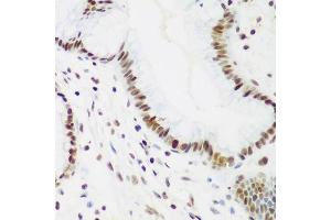 Immunohistochemistry (Paraffin-embedded Sections) (IHC (p)) image for anti-Proliferating Cell Nuclear Antigen (PCNA) (AA 1-261) antibody (ABIN3020826)