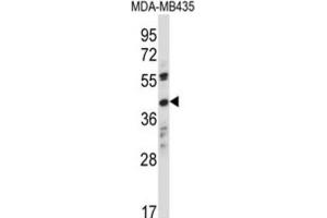 Western Blotting (WB) image for anti-Olfactory Receptor, Family 8, Subfamily K, Member 1 (OR8K1) antibody (ABIN2997661) (OR8K1 抗体)
