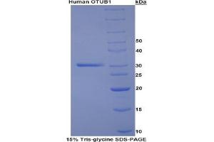 SDS-PAGE analysis of Human Otubain 1 Protein. (OTUB1 蛋白)