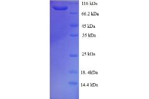 SDS-PAGE (SDS) image for GRIP and Coiled-Coil Domain Containing 1 (GCC1) (AA 4-775), (partial) protein (His-SUMO Tag) (ABIN5711636)