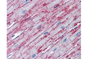 PNPT1 antibody was used for immunohistochemistry at a concentration of 4-8 ug/ml. (PNPT1 抗体  (Middle Region))