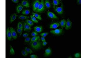 Immunofluorescence staining of A549 cells with ABIN7151851 at 1:400, counter-stained with DAPI. (EPH Receptor A7 抗体  (AA 28-182))