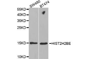 Western blot analysis of extracts of various cell lines, using HIST2H2BE antibody. (HIST2H2BE 抗体)