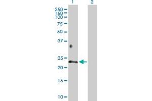 Western Blot analysis of BTC expression in transfected 293T cell line by BTC MaxPab polyclonal antibody. (Betacellulin 抗体  (AA 1-178))