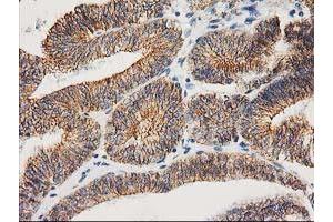 Image no. 1 for anti-Catenin (Cadherin-Associated Protein), beta 1, 88kDa (CTNNB1) antibody (ABIN1496889) (CTNNB1 抗体)