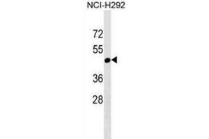 Western Blotting (WB) image for anti-Ral Guanine Nucleotide Dissociation Stimulator-Like 4 (RGL4) antibody (ABIN2999575) (RGL4 抗体)