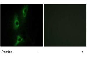 Immunofluorescence analysis of NIH/3T3 cells, using ADRB2 polyclonal antibody . (beta 2 Adrenergic Receptor 抗体  (C-Term))