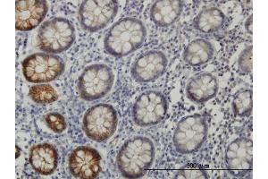 Immunoperoxidase of monoclonal antibody to EPHB3 on formalin-fixed paraffin-embedded human colon. (EPH Receptor B3 抗体  (AA 899-997))