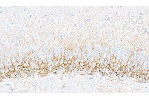 anti-Doublecortin (DCX) (AA 200-250) antibody