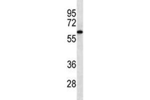 CAMKK2 western blot analysis in Jurkat lysate. (CAMKK2 抗体)