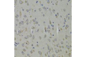 Immunohistochemistry of paraffin-embedded mouse brain using RPL9 Antibody. (RPL9 抗体)