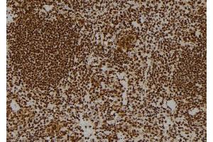 ABIN6264437 and ABIN6269102 at 1/100 staining Mouse spleen tissue by IHC-P.