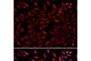 Immunofluorescence analysis of U2OS cells using PSMC2 Polyclonal Antibody (PSMC2 抗体)