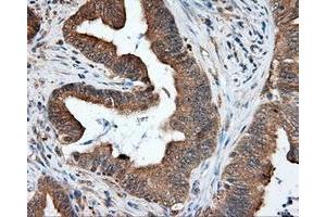 Immunohistochemical staining of paraffin-embedded liver tissue using anti-RC219453 mouse monoclonal antibody. (NPR3 抗体)