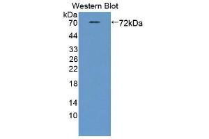 Western blot analysis of the recombinant protein. (STAM2 抗体  (AA 1-377))