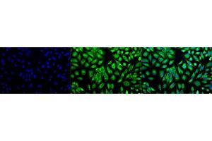 Immunocytochemistry/Immunofluorescence analysis using Rabbit Anti-PDI Polyclonal Antibody (ABIN361828 and ABIN361829). (P4HB 抗体  (AA 409-509))